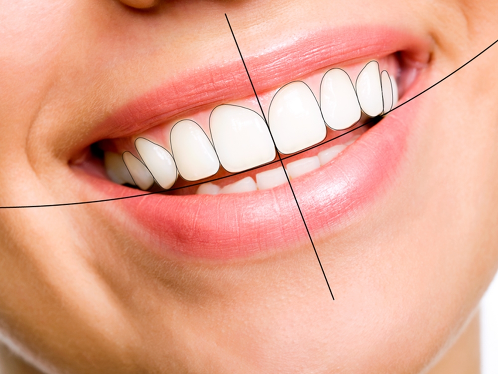 Dental İmplant