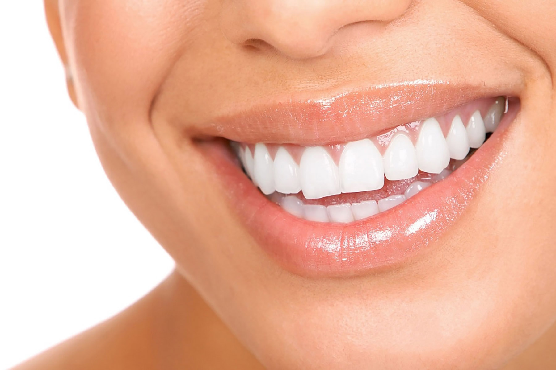 Dental İmplant